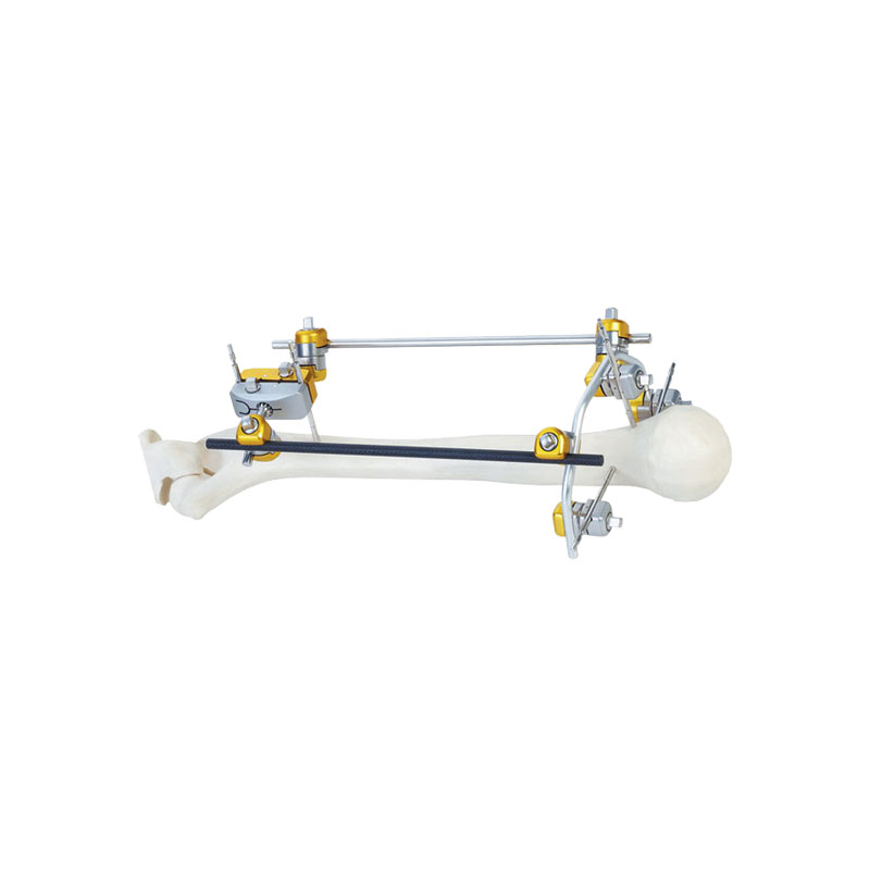 Humerus semi-ring symmetrical frame